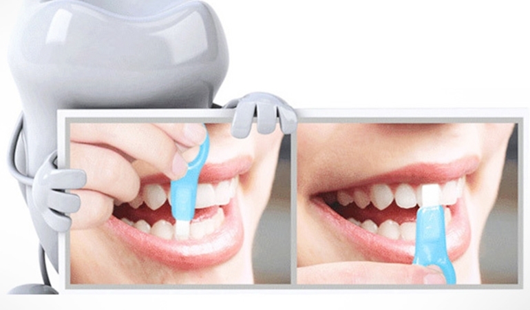 Magic Teeth Whitening Kit